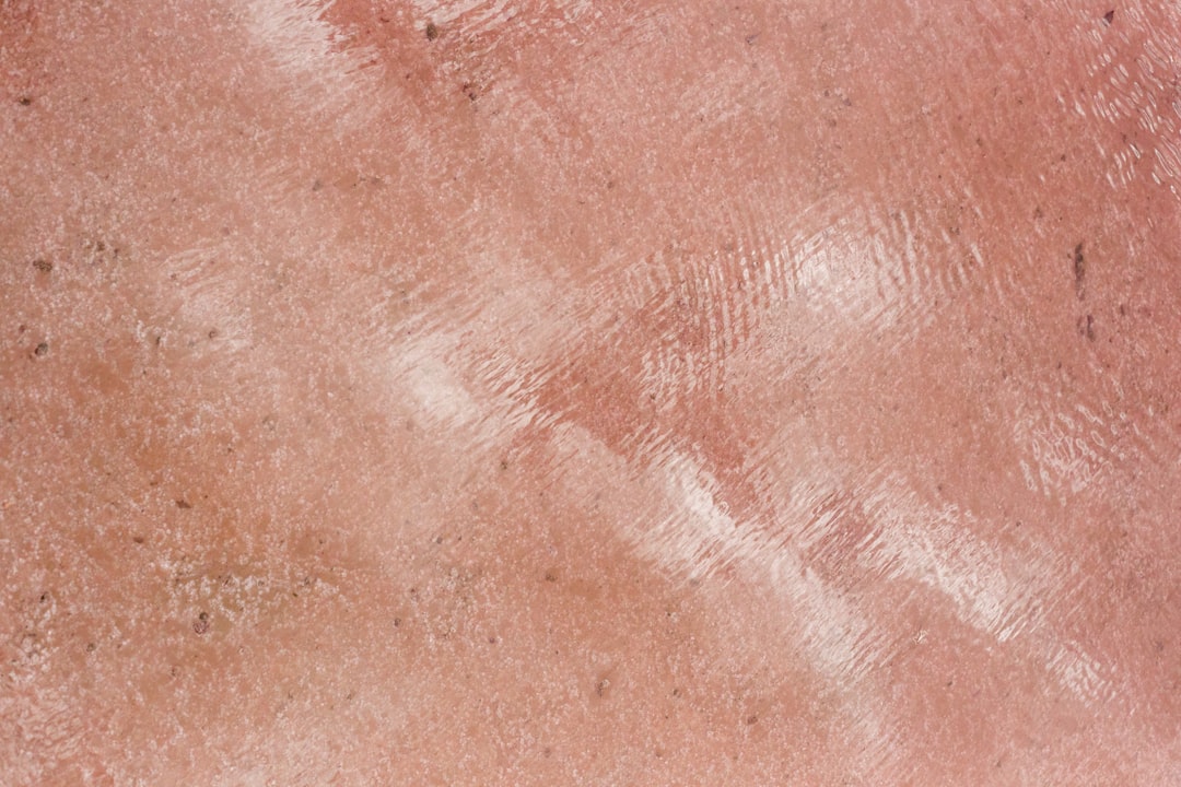 skin_mole_closeup